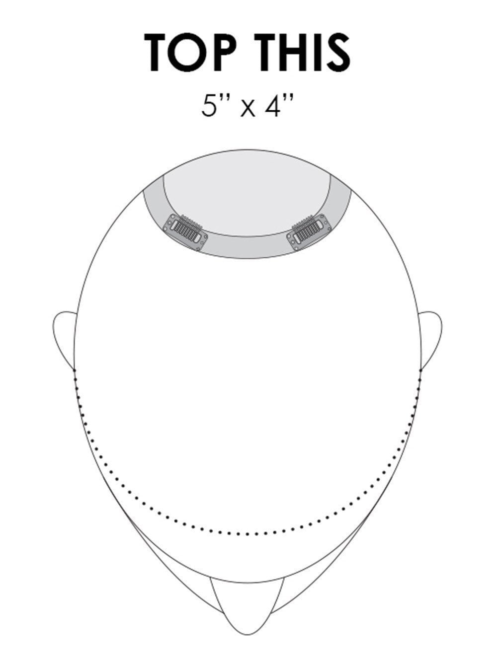 Top This 5"x4" Coverage